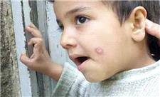 زخم سالک بر چهره رنجدیده شهرستان مرودشت فارس
