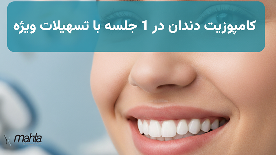 کامپوزیت دندان در ۱ جلسه + وام ۳۰۰ میلیونی (خبر خوب برای تهرانی‌ها)