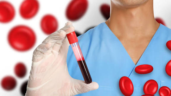 برای کم خونی چه چیزی بخوریم؟!