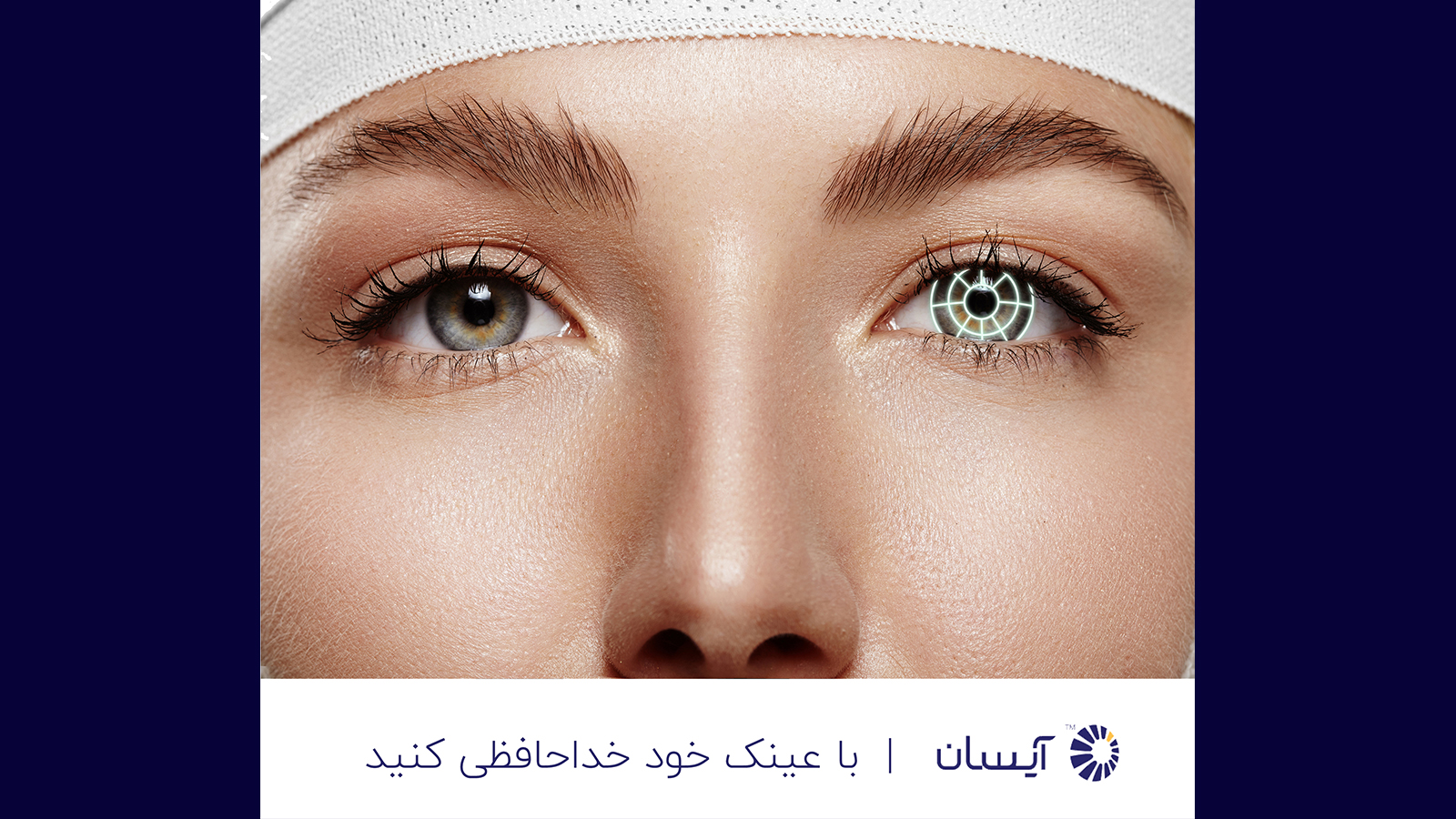 حذف عینک با پیشرفته‌ترین تکنولوژی روز دنیا؛ درچند ثانیه با عینک خداحافظی کنید