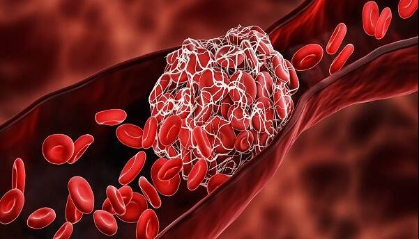 چربی خون بالا؛ دشمن خاموش رگ‌ها