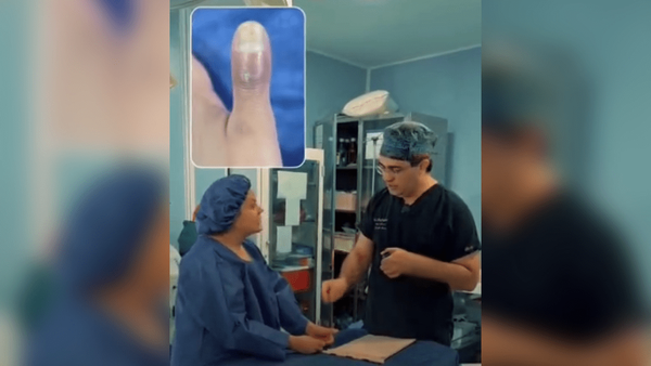 تجربه تلخ کاشت ناخن؛ زیبایی به قیمت قطع انگشت!