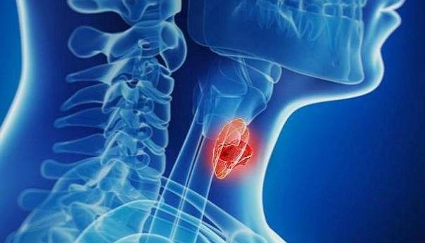 افزایش آمار تشخیص بدخیمی‌های تیروئیدی