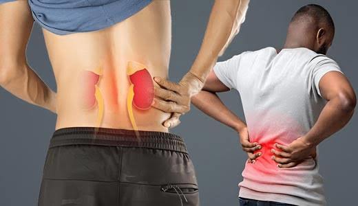 با درد کلیه در پیاده‌روی اربعین چه کنیم؟