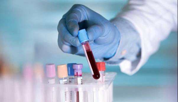 خطر HPV کاملا جدی است؛ نگرانی یک ویروس شناس